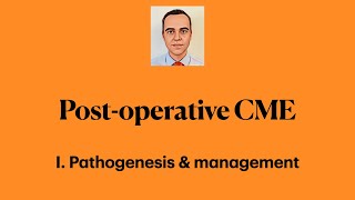 Postoperative Cystoid Macular Edema I Pathogenesis amp management [upl. by Latea]