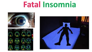 Fatal Insomnia A Rare Sleep Disorder and Treatment Explained [upl. by Timothee]