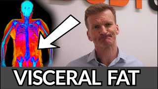 DEXA Scan amp Visceral Fat  How to calculate Visceral Fat  DEXA Body Scan UK [upl. by Imoyaba161]