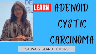 ADENOID CYSTIC CARCINOMA I SALIVARY GLAND TUMORS I BDS I MBBS [upl. by Ellimaj]