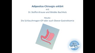 Adipositas Chirurgie erklärt Die SchlauchmagenOP oder auch SleeveGastrektomie [upl. by Rubenstein]