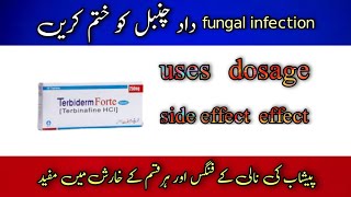 Terbiderm Terbinafine 250MG Tablet Uses Side Effects In Urdu Hindi  Fungal Infection On Skin hair [upl. by Alberic]