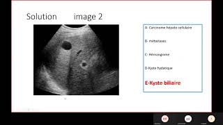 Radio  Limagerie du foie pancréas et voies biliaires [upl. by Aridnere]