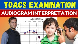 Audiogram interpretation and reading made easy conductive sensorineural and mixed hearing loss [upl. by Tania192]