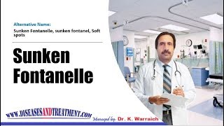 Sunken Fontanelle  Causes Diagnosis Symptoms Treatment Prognosis [upl. by Learrsi]