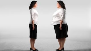 What is Body Dysmorphic Disorder  Eating Disorders [upl. by Nolyad]