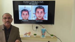 Deviated nasal septum Hindi Patient teaching programme [upl. by Roberson]