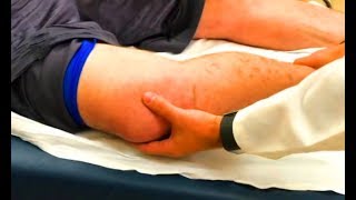 How to Fix a Nursemaids Elbow at Home [upl. by Allicsirp]