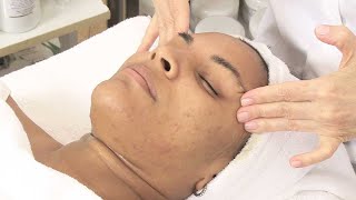 Boosting Treatment for Acne amp Light Scarring [upl. by Talyah]