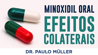 Efeitos colaterais do Minoxidil Oral  Dr Paulo Müller Dermatologista [upl. by Milewski426]