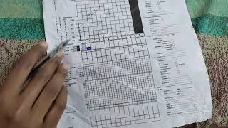 PARTOGRAM understanding needed for OSPE its simple [upl. by Grishilde]