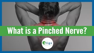 How a Pinched Nerve Happens amp What to Do About It [upl. by Catrina663]