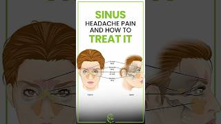 Sinus Headache Pain and How to Treat It [upl. by Gudren628]