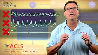 ACLS Adult Cardiac Arrest Algorithm  PEAAsystole [upl. by Pazia134]