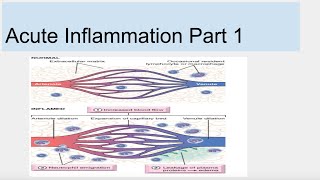 Acute Inflammation Part 1 [upl. by Fabiolas]