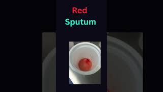 Sputum Phlegm Sputum Color of your sputum [upl. by Abrams]