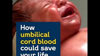 How umbilical cord blood could save your life [upl. by Michiko]