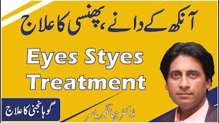 Gohanjni ka ilaj  Stye on eyelid  Guhanjni ka ilaj  Eye Stye Treatment in Urdu DrJahangirYasir [upl. by Durst]