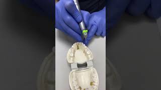 Implant Placement Demonstration First Part [upl. by Hun655]