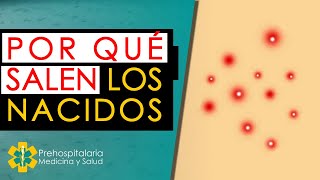 POR QUÉ DAN LOS NACIDOS  Cual es LA CAUSA de los FORUNCULOS 😱😱😱  Nacidos  FORUNCULO PORQUE SALEN [upl. by Inigo]