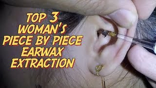 Top 3 Womans Piece by Piece Earwax Extraction [upl. by Benjamen]