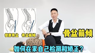 骨盆前倾，如何在家自己检测和矫正？中医老师3分钟教会你 [upl. by Stephen]