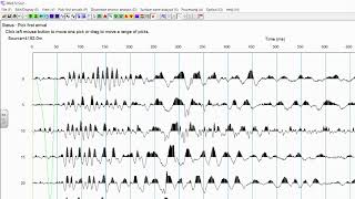 SeisImager2D Seismic Refraction data processing [upl. by Archie]