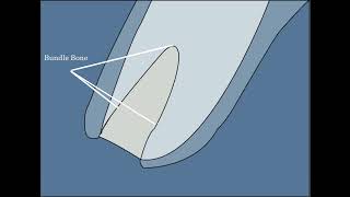 Sequence of bone remodeling after an extraction [upl. by Muna]