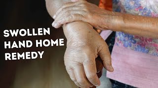 Hand Swelling Home Remedy What to do when Hand Swells [upl. by Yank394]