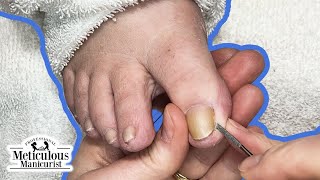 Pedicure Tutorial on Thick Tight Toenail Discomfort [upl. by Nedyrb]