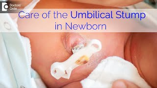 CARE for Umbilical Cord Stump in Newborn  Follow These Simple Steps Dr Harish C  Doctors Circle [upl. by Azer]