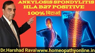 Hla b27 positive क्या है और उसका होमेओपेथी उपचार l Dr harshad Raval MD Homeopath [upl. by Yliak]