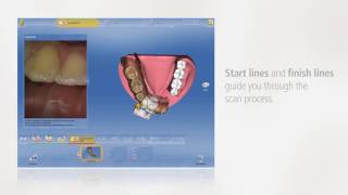 CEREC  Guided scanning [upl. by Gunilla]