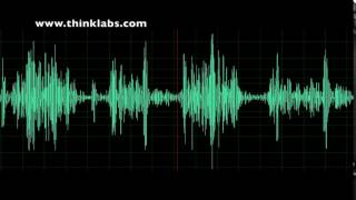 Ventricular Septal Defect Animation [upl. by Zanas550]