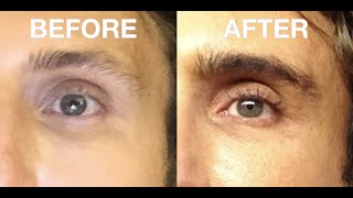 How To Grow Thicker Fuller Eyebrows Brows and Eyelashes for men Fast [upl. by Sille374]