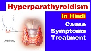 Hyperparathyroidism msn  Cause symptoms management  endocrine disorders [upl. by Perot]