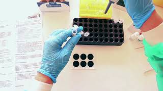 Determination of antistreptolysin O ASLO by agglutination method LATEX [upl. by Itirahc804]