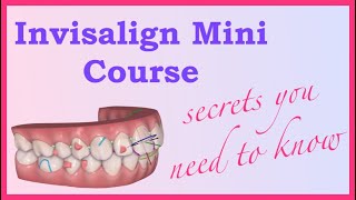 The Basics  Invisalign Mini Course 1 of 8 [upl. by Greer996]