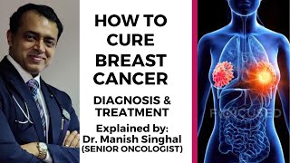 How to Cure Breast Cancer  Breast Cancer Treatment  Explained by Dr Manish Singhal [upl. by Vijnas]