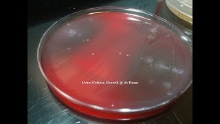 Urine Culture Colony Growth with Multiple Bacteria [upl. by Zelma453]