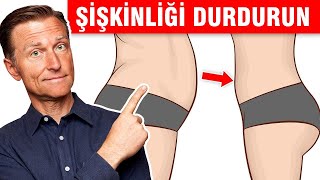 Şişkinliği Ortadan Kaldırın  Dr Berg Türkçe [upl. by Henrietta949]