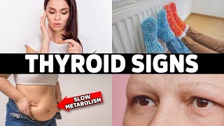 HYPOTHYROIDISM Don’t Ignore These 7 Early Warning Signs [upl. by Trista]