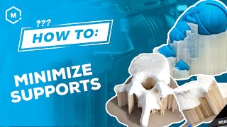 How To Minimize Supports for 3D Prints [upl. by Shriner]