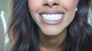 My Dental Implant Surgery Experience PART ONE  My Story  Tips For You  Mariah Navit [upl. by Lodmilla133]