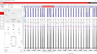 Profis Detection Tutorial 3  PS 300 Ferroscan [upl. by Washington545]