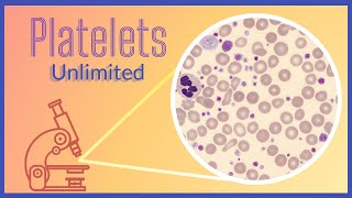 Identifying Essential Thrombocythemia  Heme Ed [upl. by Naihs]