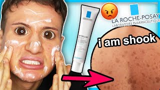 I tried La Roche Posay EFFACLAR DUO for ONE WEEK dark spots are still here [upl. by Calica]