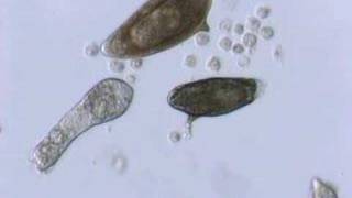 Schistosoma mansoni mother sporocyst and eggs [upl. by Garlaand13]