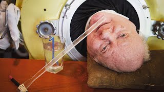 Longest Living Polio Survivor in Iron Lung Dead at 78 [upl. by Alegnaoj]