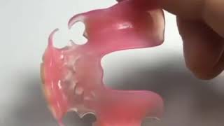 Valplast Flexible Denture [upl. by Dorsman240]